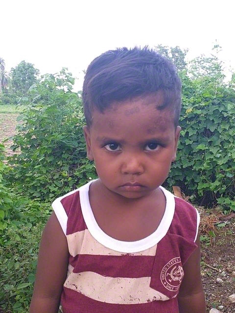 World Vision India